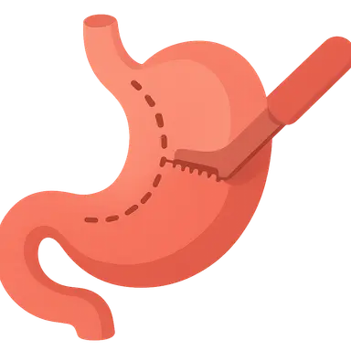 Gastric surgery procedures