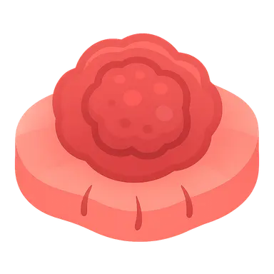 Granulomatous Inflammation