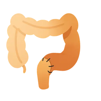 Elective colorectal procedures