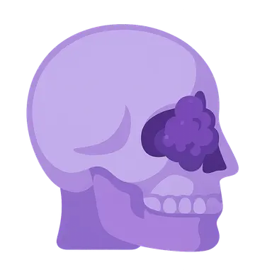 Esthesioneuroblastoma