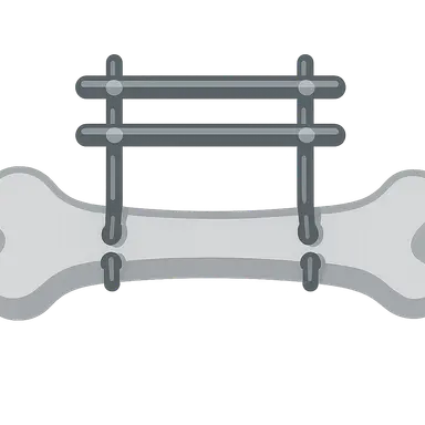 External fixation principles