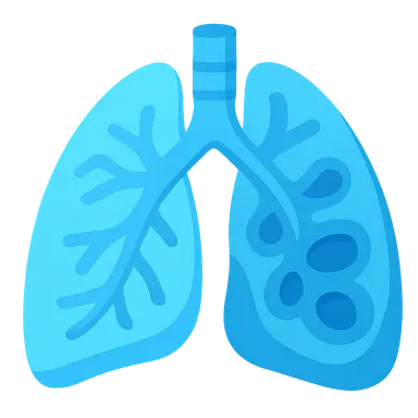 Bronchiectasis