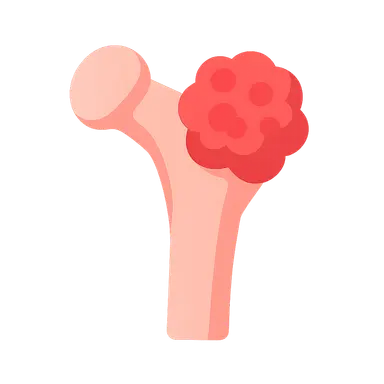 Malignant Primary Bone Tumors