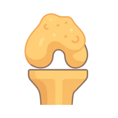 Biofilms in Orthopaedic Infections