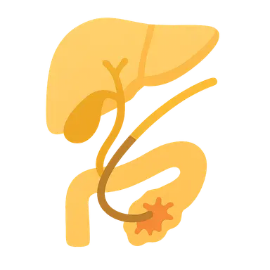 ERCP and Its Complications