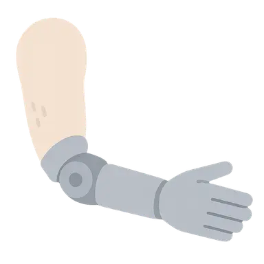 Upper Limb Prosthetics
