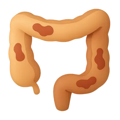 Inflammatory Bowel Disease