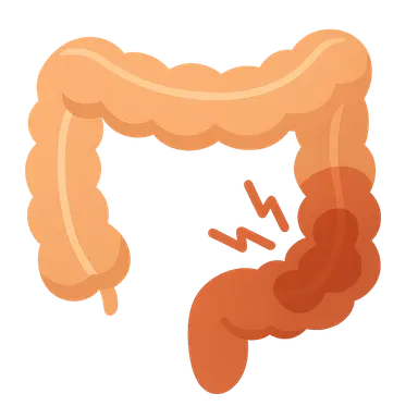 Irritable bowel syndrome