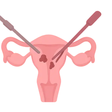 Endometriosis surgical management