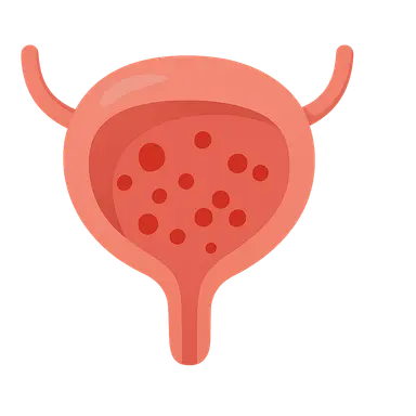 Hematuria Evaluation