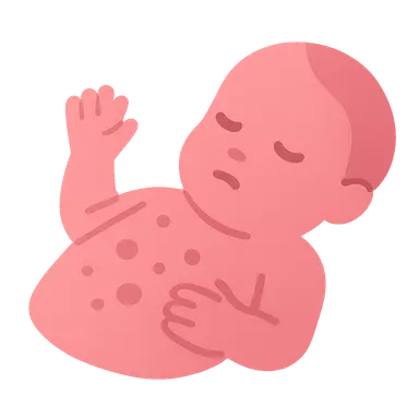 Group B streptococcal disease