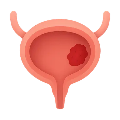 Bladder Cancer