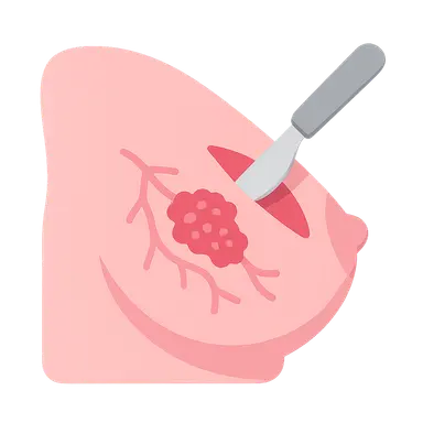 Management of Ductal Carcinoma In Situ