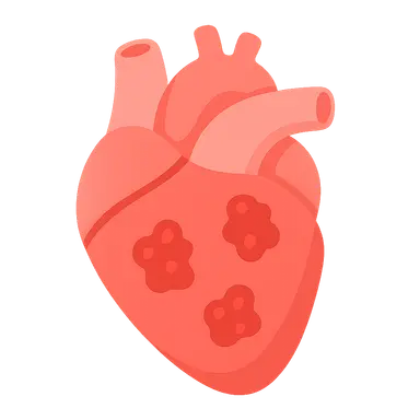 Infective endocarditis