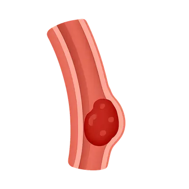 Venous Thromboembolism
