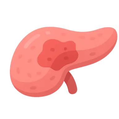 Severity assessment in acute pancreatitis