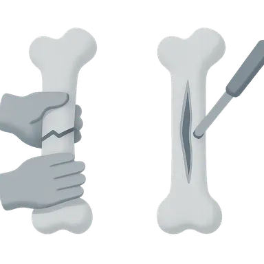Open vs closed reduction techniques