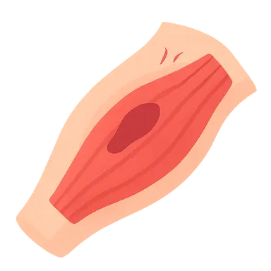 Muscle Strains and Contusions