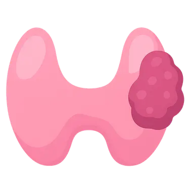 Thyroid neoplasms