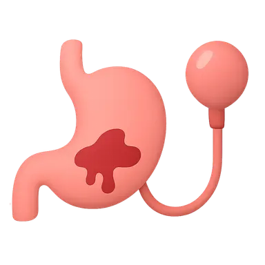 GI bleeding management