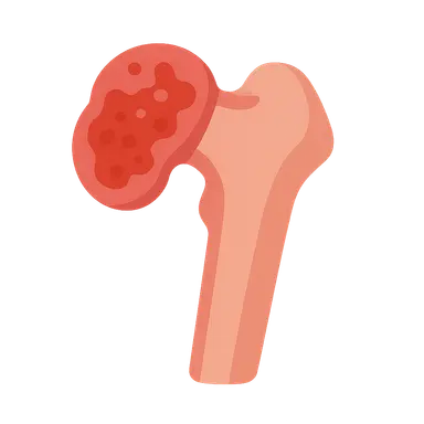 Bone and joint infections