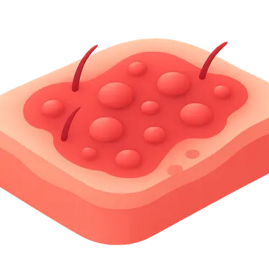 Inflammatory dermatoses