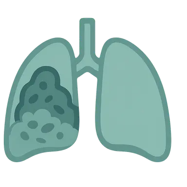 Biofilms in cystic fibrosis
