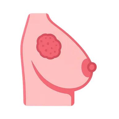 Breast cancer staging and surgical management