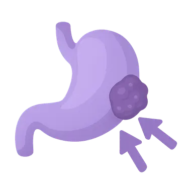 Neoadjuvant and adjuvant therapy timing