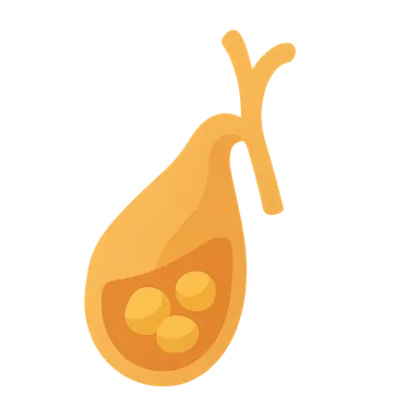 Cholelithiasis and Cholecystitis