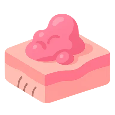 Non-melanoma skin cancers