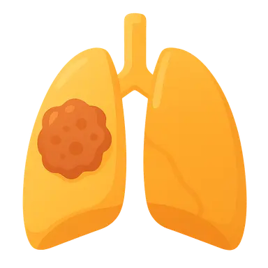 Occupational Cancers