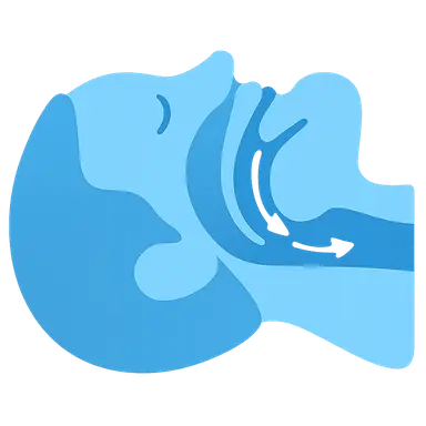 Pathophysiology of Sleep-Disordered Breathing