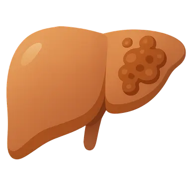 Drug-induced liver injury