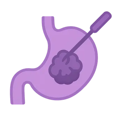 Minimally Invasive Approaches in Cancer Surgery