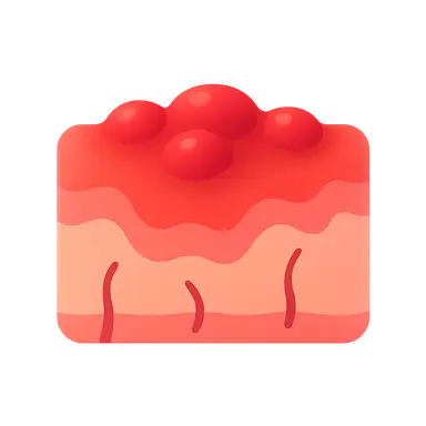 Chronic inflammation