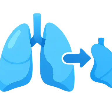 Lung transplantation