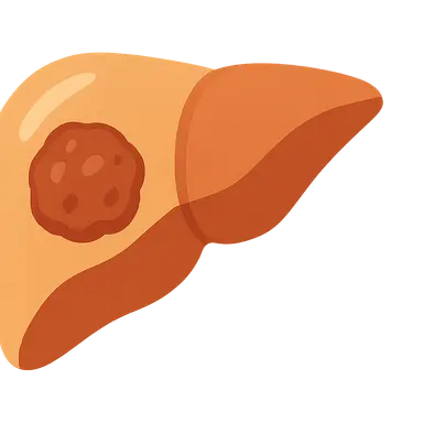 Hepatocellular carcinoma
