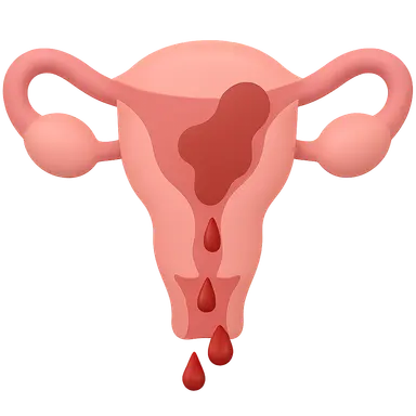 Definition and classification