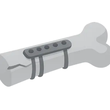 Internal fixation methods
