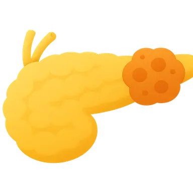 Pancreatic endocrine tumors