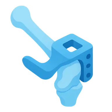 Patient-Specific Instrumentation