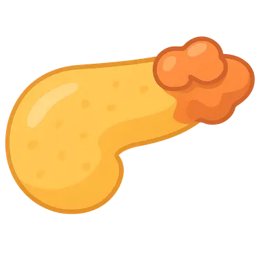 Autoimmune pancreatitis