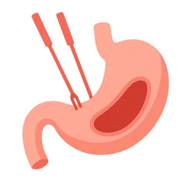 Conversion to open surgery criteria