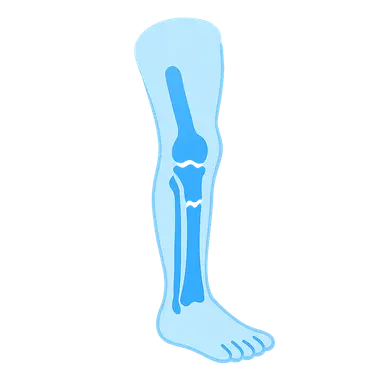 Pediatric orthopedic emergencies