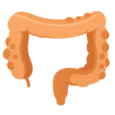 Diverticular Disease