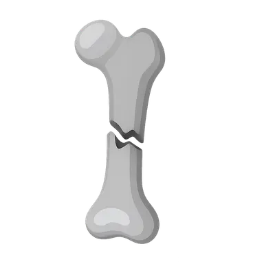 Lower Limb Fractures