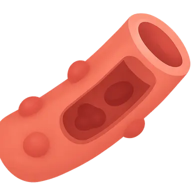 Small vessel vasculitis