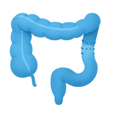 Hirschsprung disease management