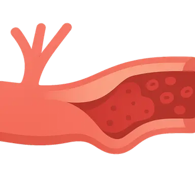 Ischemia-reperfusion injury